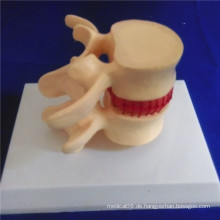Menschliche Skelettwirbel Säule Medizinische Demonstration Biologie Modell